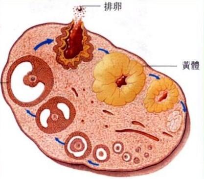 通常黄体囊肿破裂有两种情况.