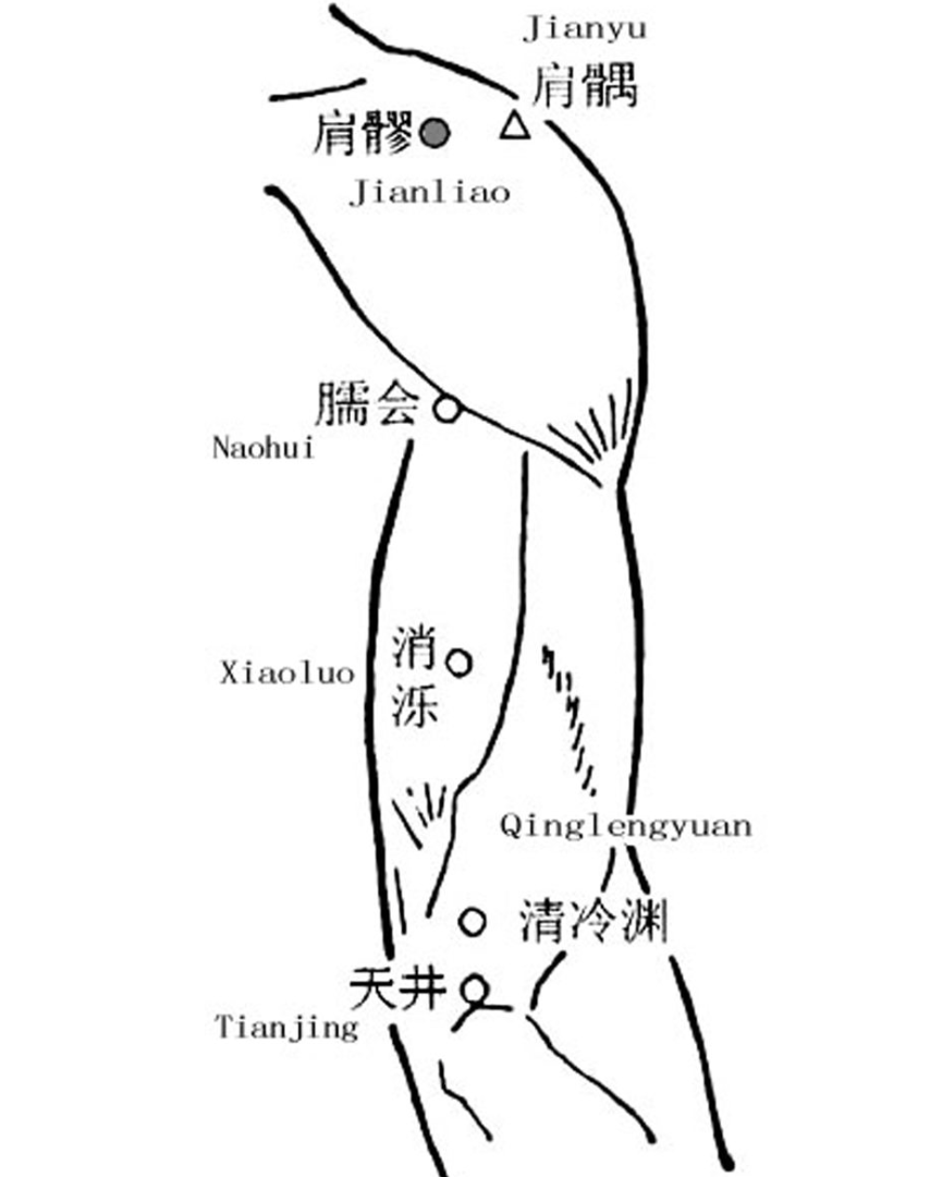 「肩周炎」按摩这些穴位可改善