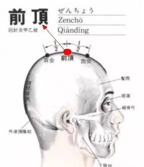 【穴位解剖】在帽状腱膜中;有左右颞浅动,静脉吻合网;布有额神经分支