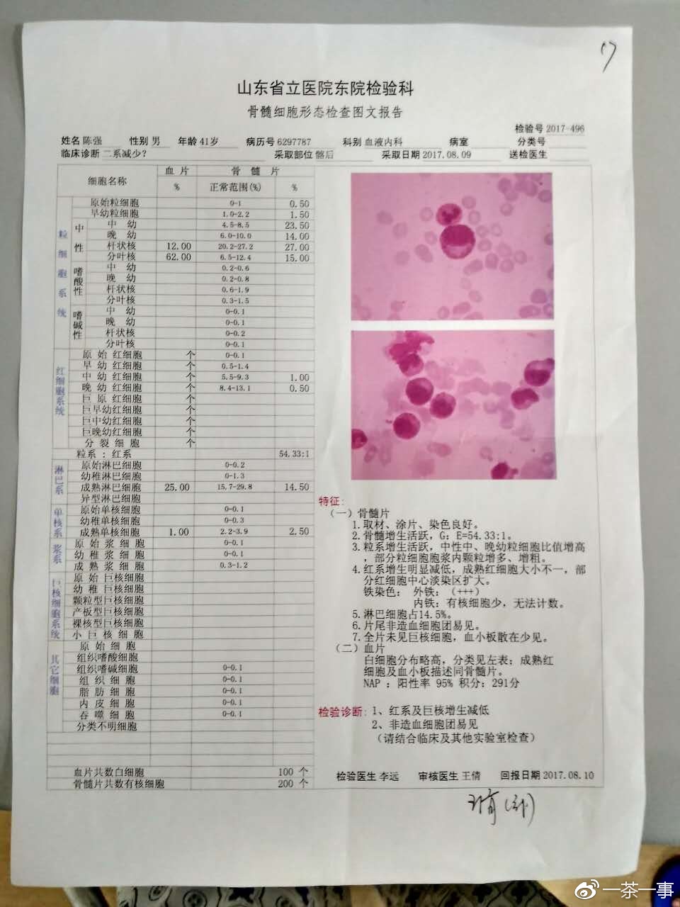 【求救信】世界罕见艾迪生病患者,同时患上了恶性纵隔