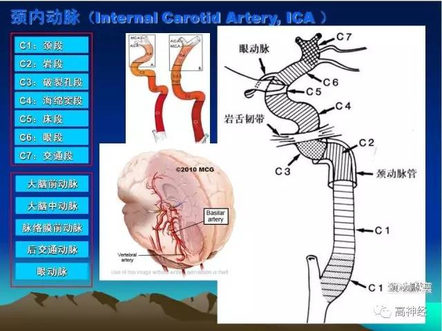 脑动脉解剖及分段