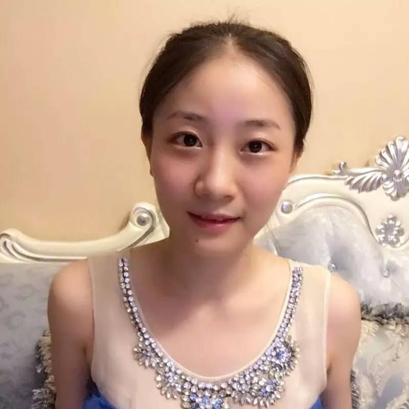 虎牙李美霞图片