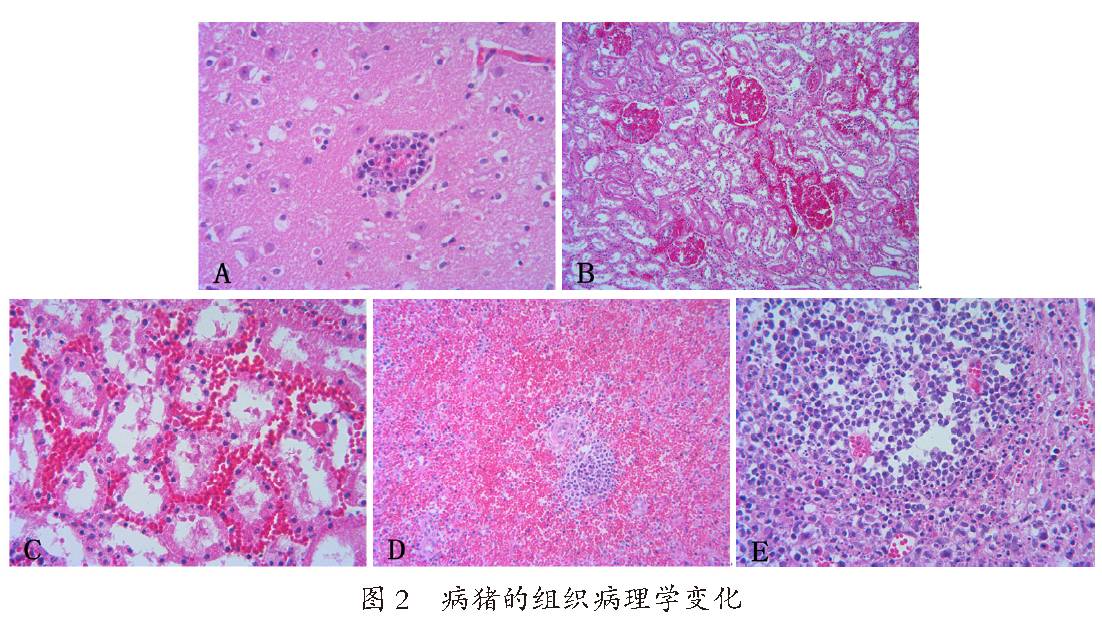 淋巴细胞和单核细胞浸润形成"脑血管袖套现象"(图2-a);肾小球体积增大