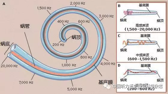 菜刀解剖青蛙——由近期的双侧人工耳蜗植入所想