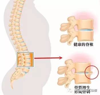 中医治疗腰椎病的原理是什么_幸福是什么图片