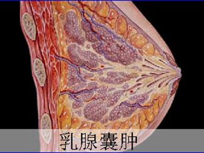 哺乳的不良习惯   乳腺囊肿在喂乳女性身上多发就是这原因了,因为