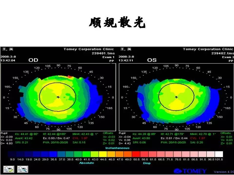 【微课堂】关于"散光"的那些事儿(上)