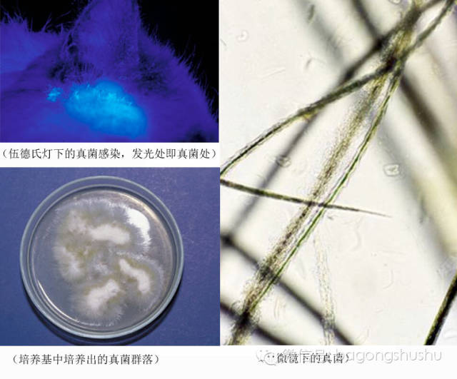 准确率比肉眼判别要高得多了. 人的脚气感染,也是一种真菌感染.