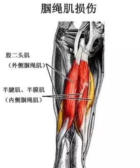 跑者肌肉拉伤不可小觑 闪电博尔特也难逃伤病魔掌