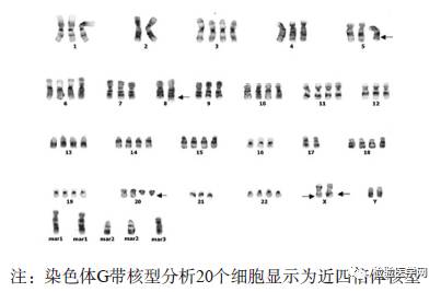 染色体g带核型分析图 2.3 治疗经过