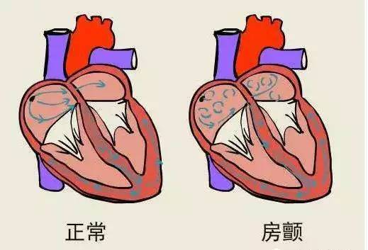 有血栓的人口比例_腿上有血栓真人图片(2)