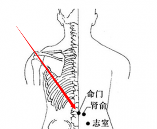 经期腰酸,头疼,乳房疼,半根艾条就能止痛