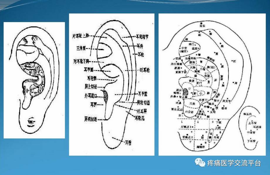 耳穴高清大图