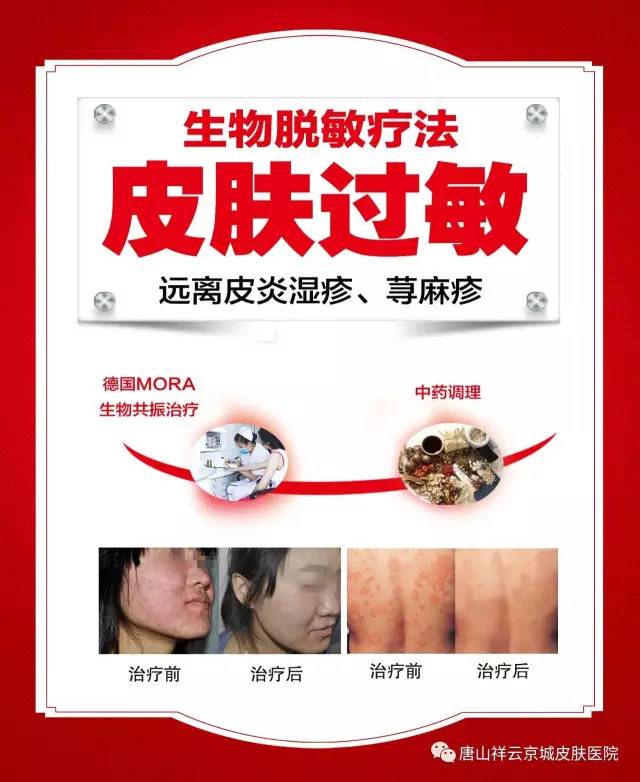 协和医院招聘_北京协和医院眼科技术员招聘信息(3)