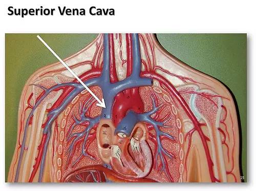 解剖学 上腔静脉位于中纵隔,由两支无名静脉汇合而形成,收集头颈部