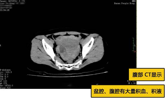 房事太生猛容易要了命