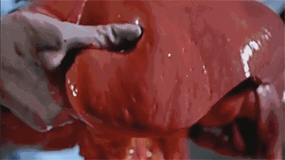 开始解剖,可以看到,肝脏的表面是粉红色的,并且比一般的肝脏更软,这就