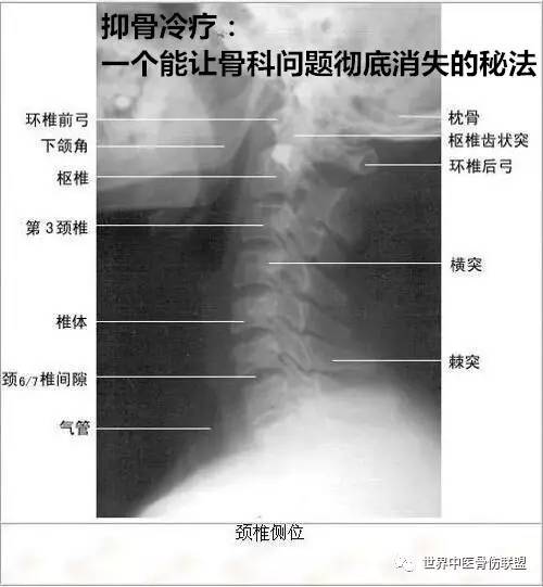 颈椎退变是什么意思