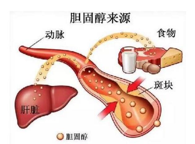 三,低密度胆固醇危害大