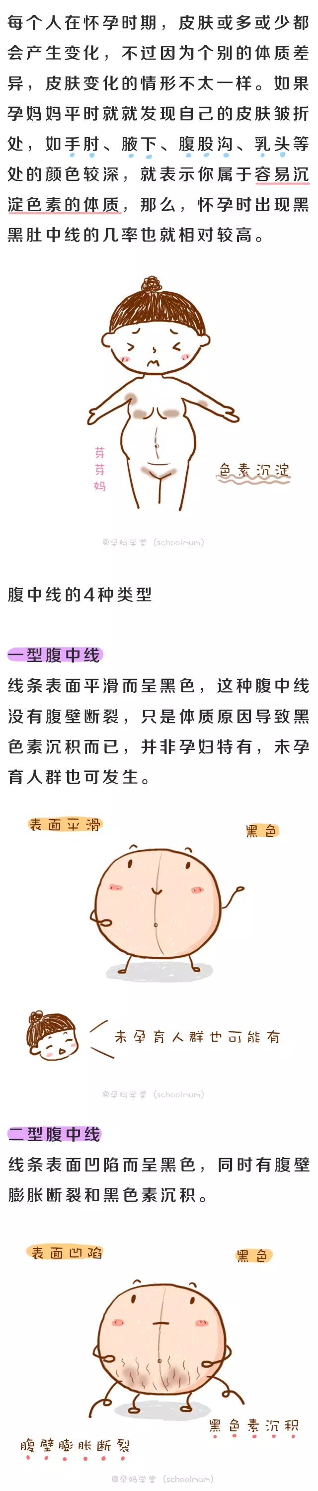 为什么孕妈肚子上会有一条黑线?