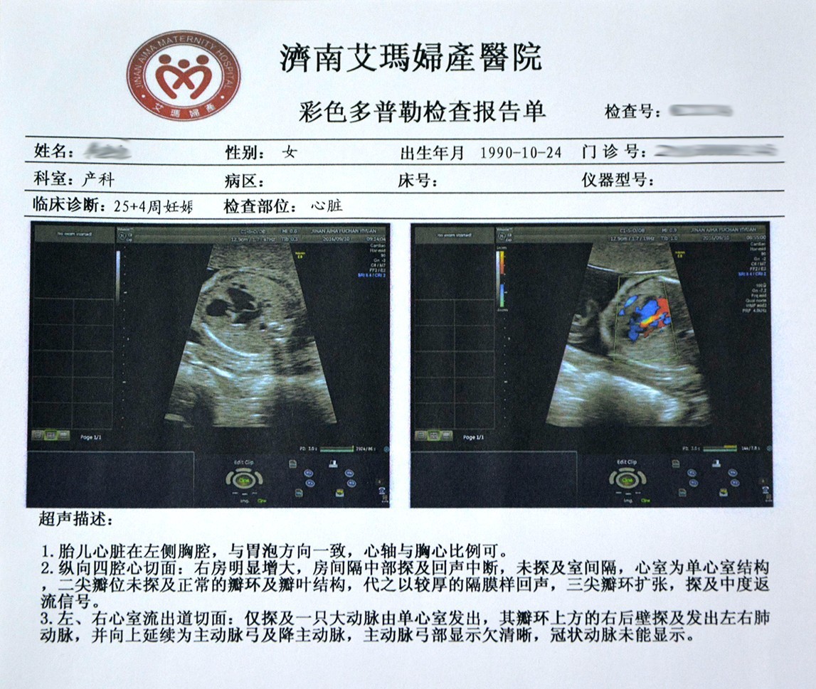 我院引进高端妇产超声专用机助力筛查胎儿先天性心脏病 - 徐州市第一人民医院