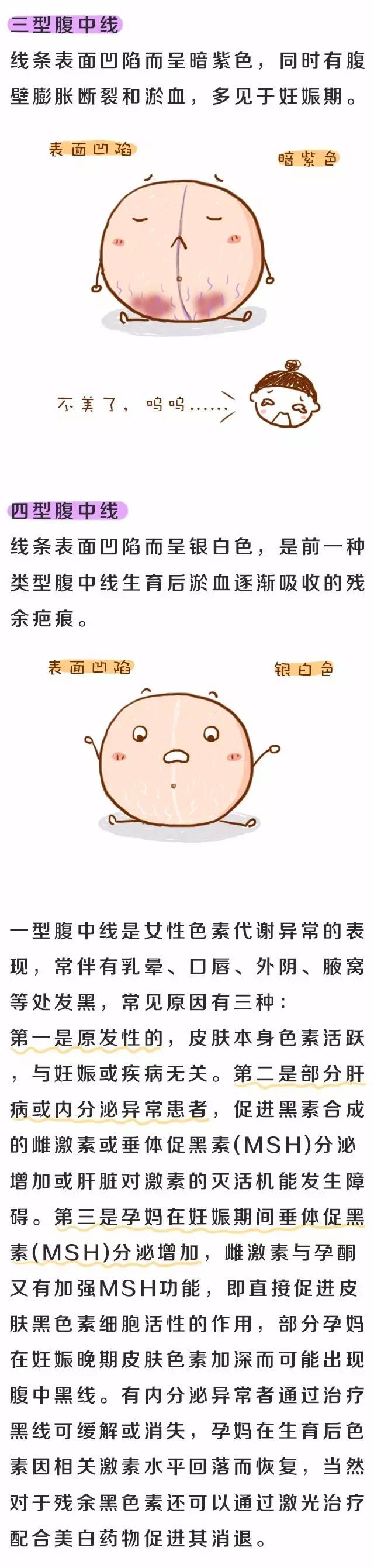 为什么孕妈肚子上会有一条黑线?