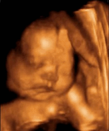 胎儿在肚子中生活无聊吗?几张图告诉你,胎宝宝节目多到你数不清