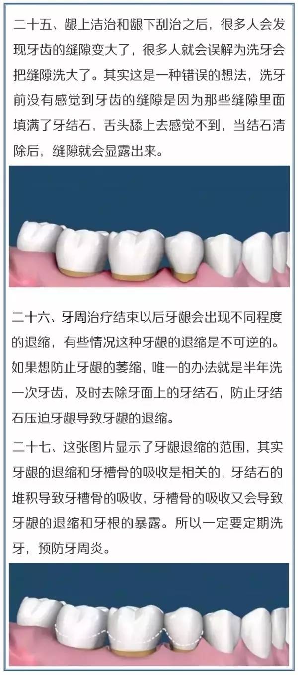 北京博爱口腔温馨提示