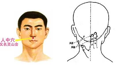 5,人中--风府:主治卒然口噤,昏迷不语或癫狂歌哭,精神失常等疾.