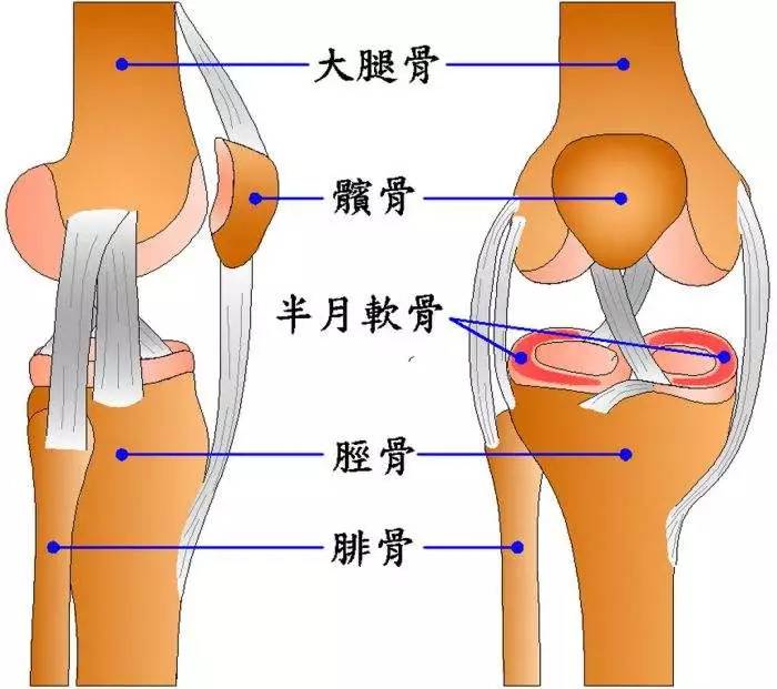 膝关节疼痛,打软腿……原来是"游离体"在作怪!