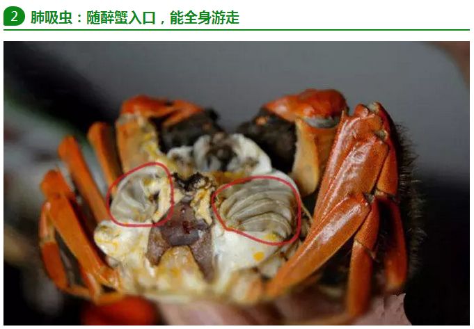 轻信生吃螃蟹可以长力气 重庆男孩患肺吸虫病