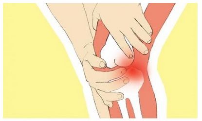 股骨头坏死症状易被误诊的膝关节疼痛