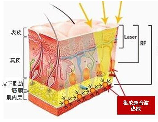 茶叶抗衰老的原理是什么_盛世经典茶叶是什么茶(3)