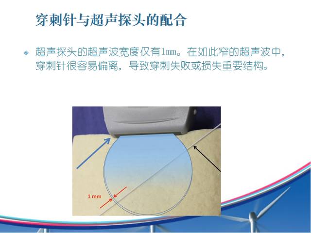 实用教程 超声下穿刺针与探头的配合