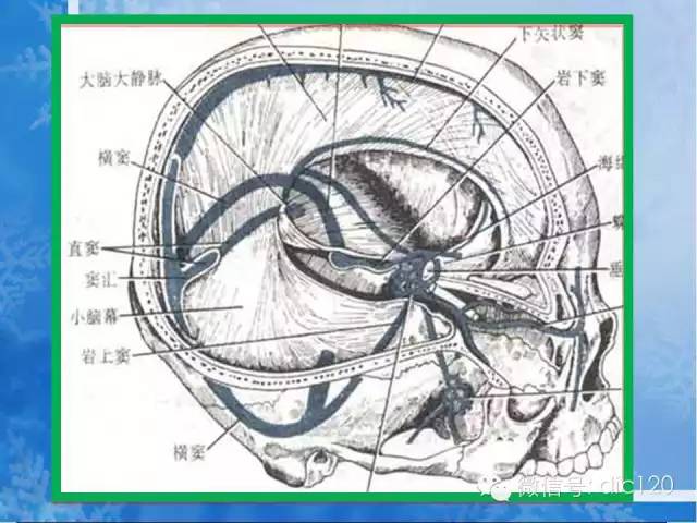 脑静脉解剖