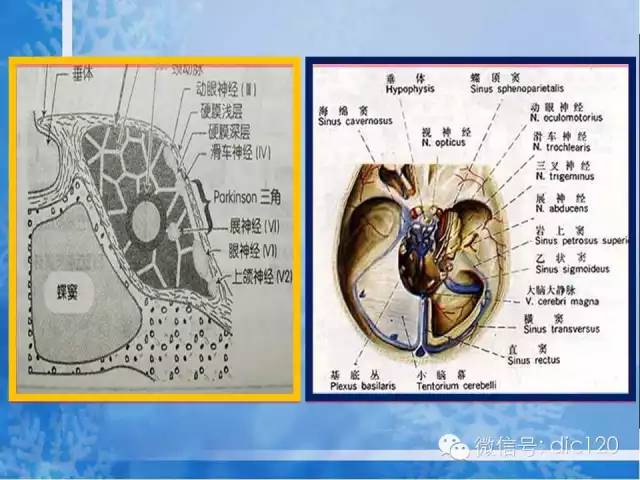 脑静脉解剖