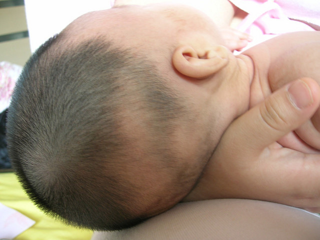 宝宝缺钙的9大征兆,早发现早补钙 