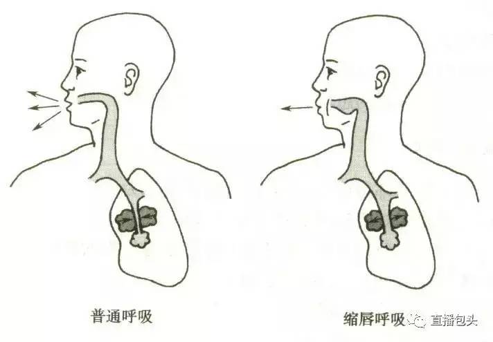 缩唇呼吸与正常呼吸对比示意图