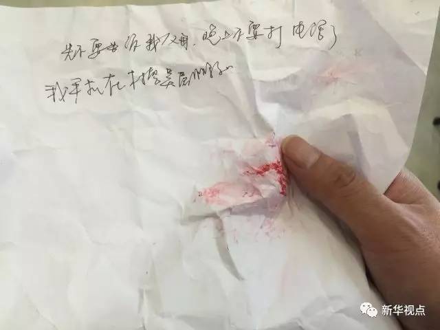 黄文斌的脸部,脖子,手臂均受伤,其中脸部伤情最为严重,郑利生背部