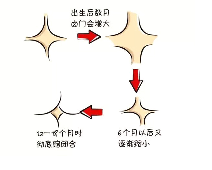 宝小脑袋的发育状况，可以看出很多端倪