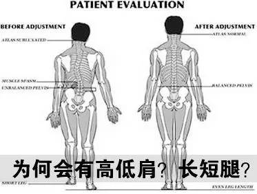 骨盆修复的原理_仪器骨盆修复和徒手的哪个更适合 看完这篇文章你就知道了(3)