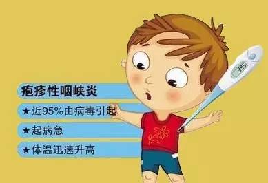 [儿童科普] 夏秋季,还是要注意疱疹性咽峡炎