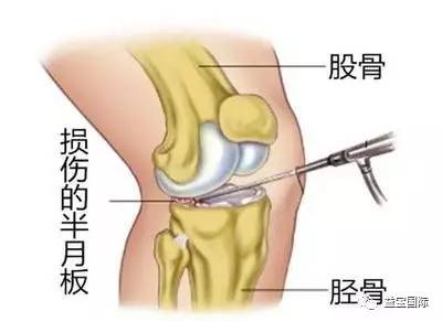 眼睛瘙痒与疼痛：常见原因及应对措施