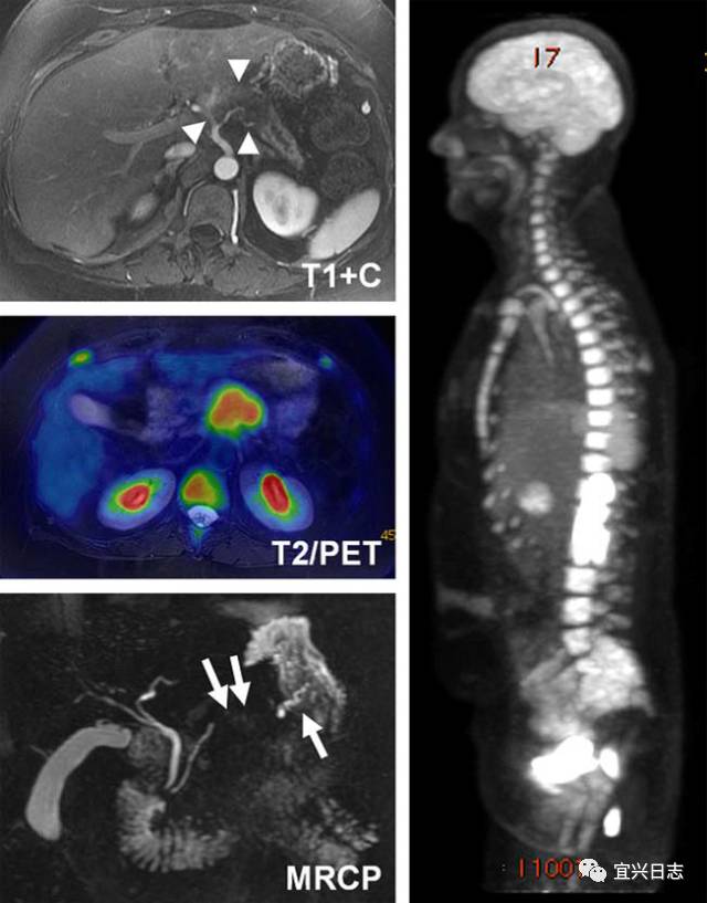  Difference Between CT and PET CT: Understanding the Distinctions