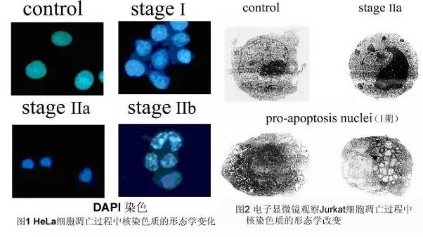 电子显微镜虽然光学显微镜下可以看见胞膜起泡现象和凋亡小体,但凋亡