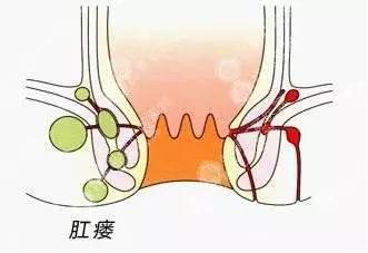 疖子的原理_疖子的图片(2)