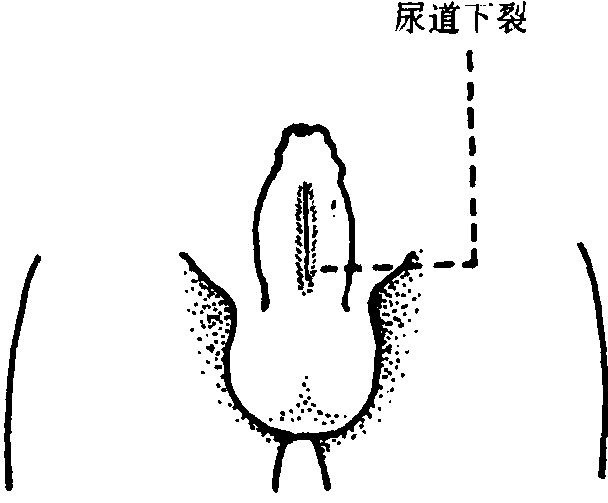 主任,有许多家长还想了解一下,孩子术后的情况.