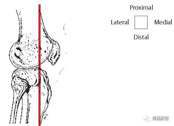 解剖膝关节mri冠矢状双语