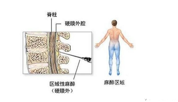 女人生孩子打一成语是什么_女人从什么地方生孩子(2)