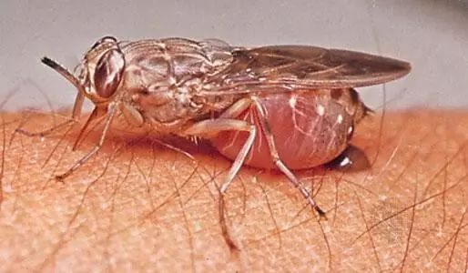 福州一女子被"苍蝇"叮咬后染上罕见感染性疾病险